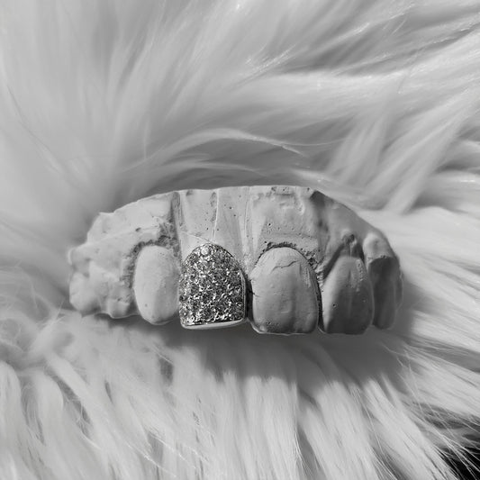 ESCARCHA (PARRILLA PLATA)