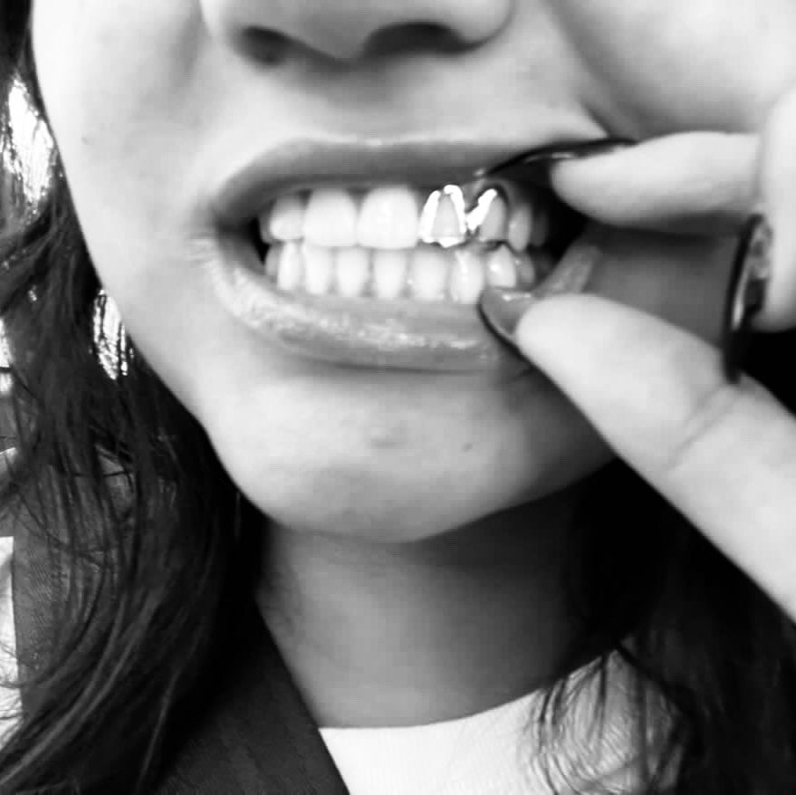 SPARK (SILVER GRILLZ)