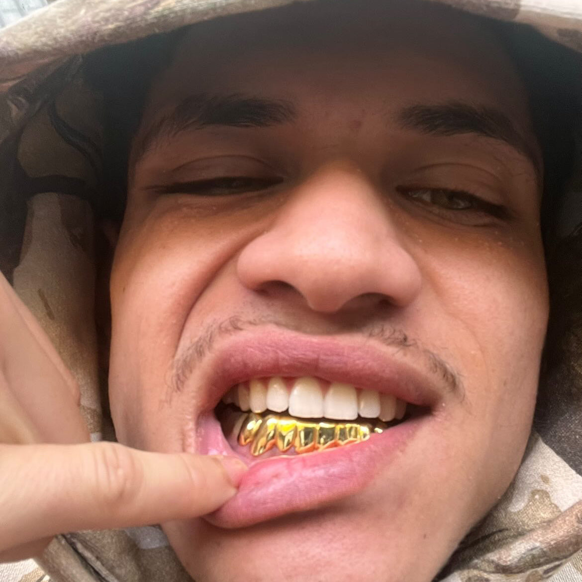 NEXIUM (8 PC GOLD GRILLZ)