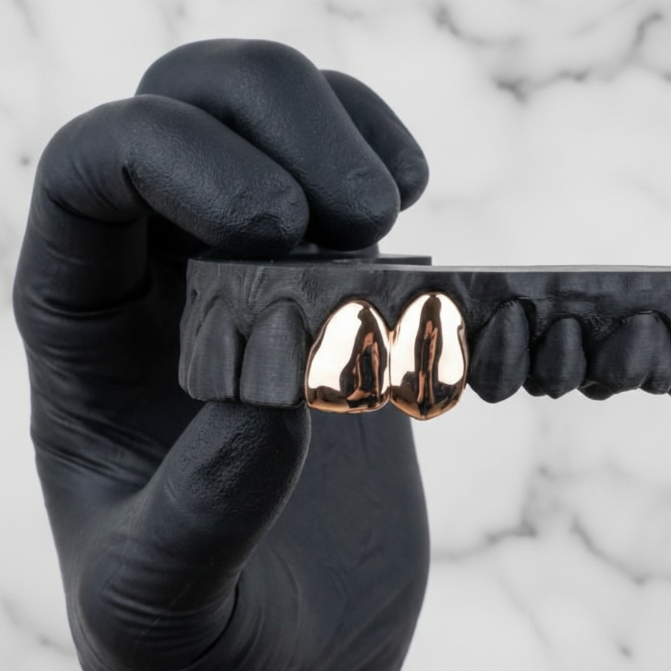 NOVA (GOLD PLATED GRILLZ)