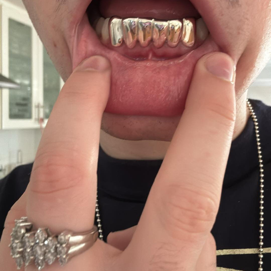 NEXON (6 PC SILVER GRILLZ)