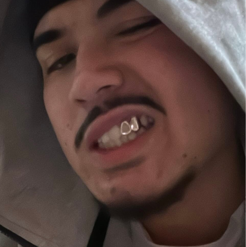 PRISM (SILVER GRILLZ)