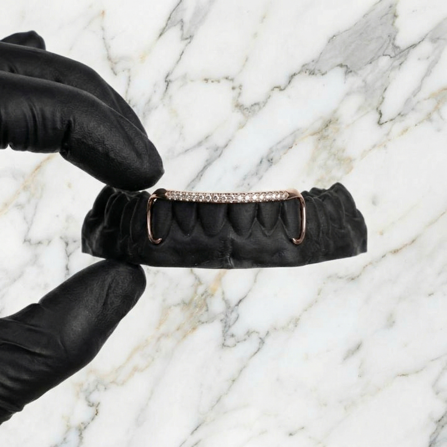 AURIX (GOLD PLATED GRILLZ)