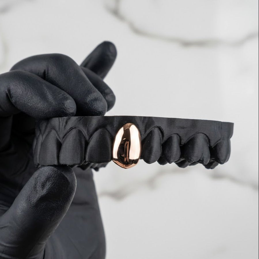 ION (GOLD PLATED GRILLZ) - Rose - HC Grillz