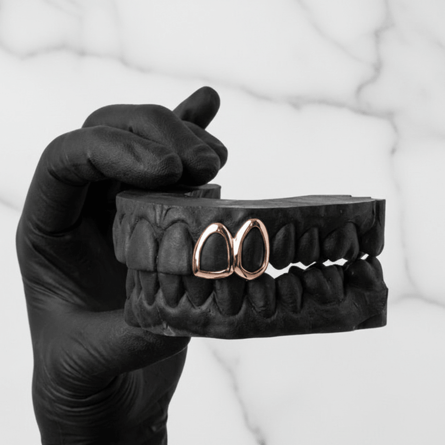 SPARK (GOLD GRILLZ) - 10k - HC Grillz