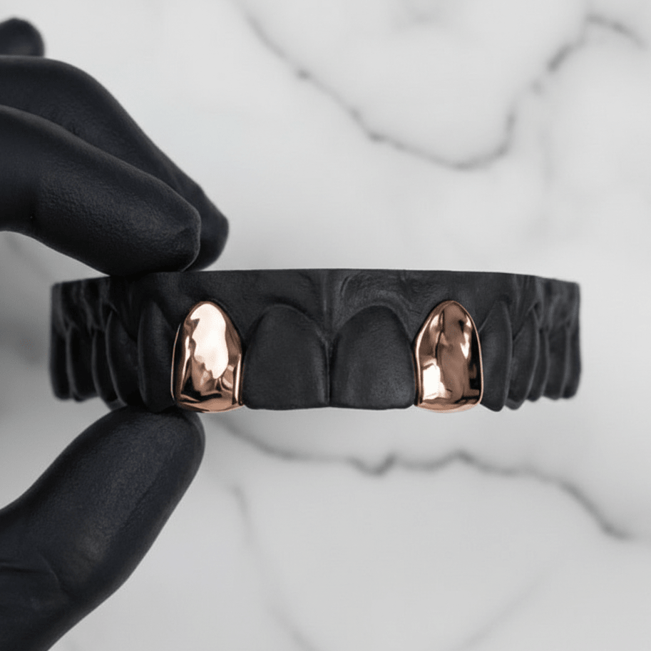 SURGE (GOLD PLATED GRILLZ) - Rose - HC Grillz