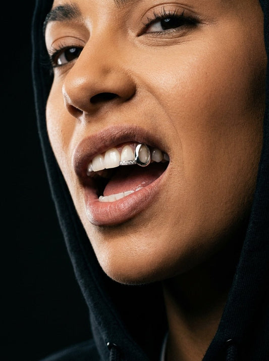 Can You Get Grillz if You Have Braces? What You Need to Know - HC Grillz