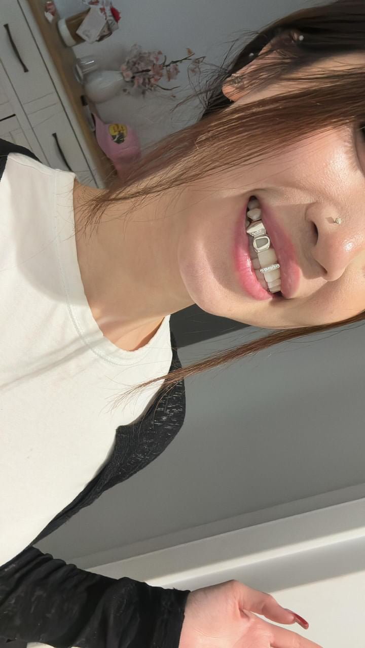 Shine Bright with Your Grillz: Expert Tips for Long-Lasting Care - HC Grillz