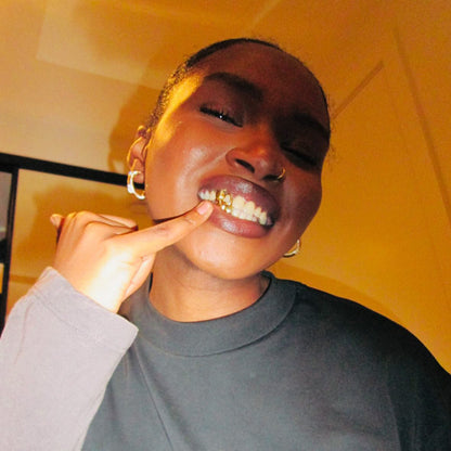 PRISM (GOLD PLATED GRILLZ)