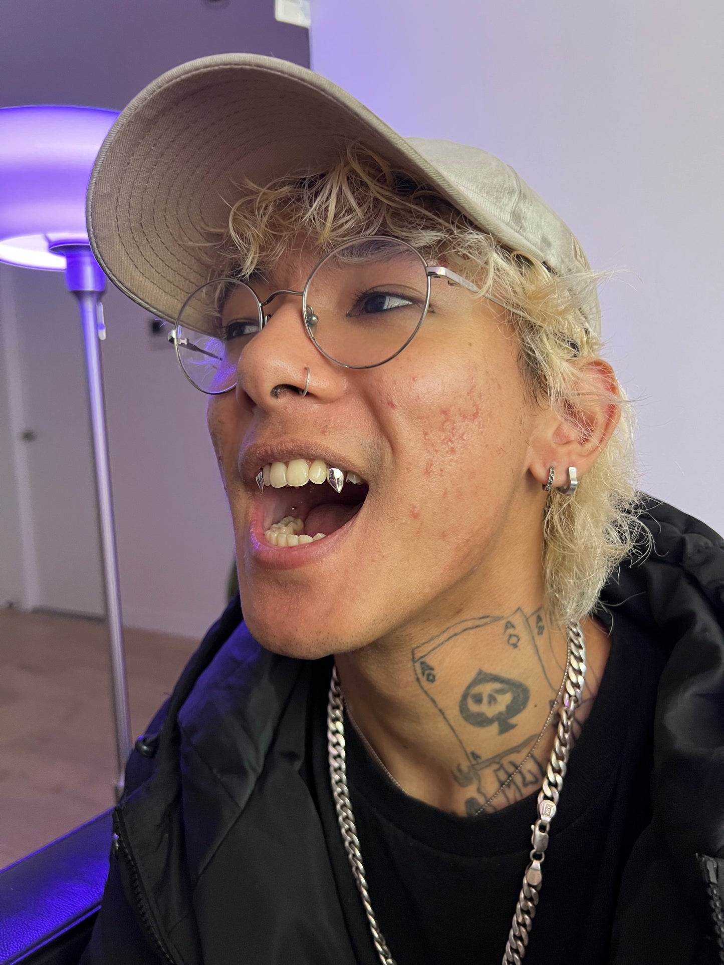 CRIMSON (SILVER GRILLZ)