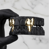 JET (GOLD PLATED GRILLZ)