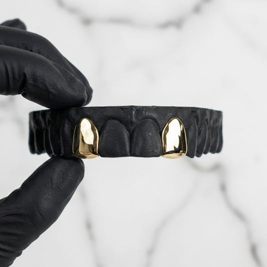 SURGE (GOLD PLATED GRILLZ)