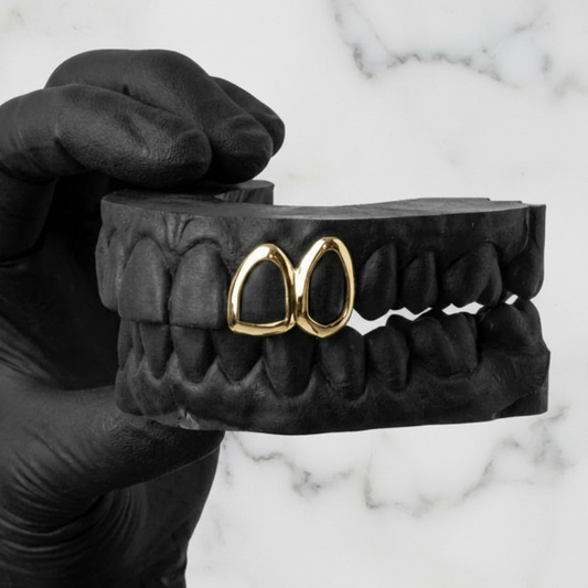 SPARK (GOLD PLATED GRILLZ)