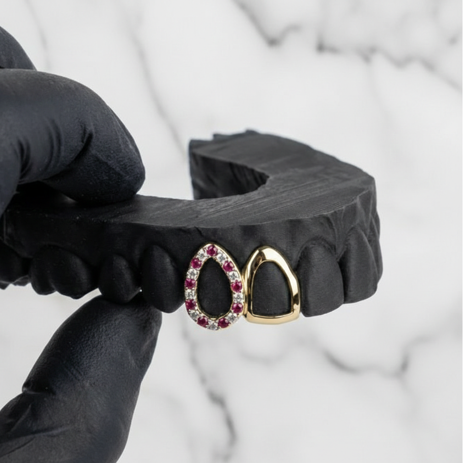 TESSER (GOLD GRILLZ)