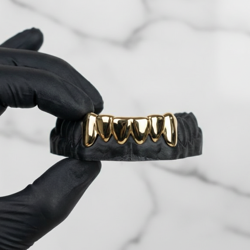 NEXON (6 PC GOLD PLATED GRILLZ)