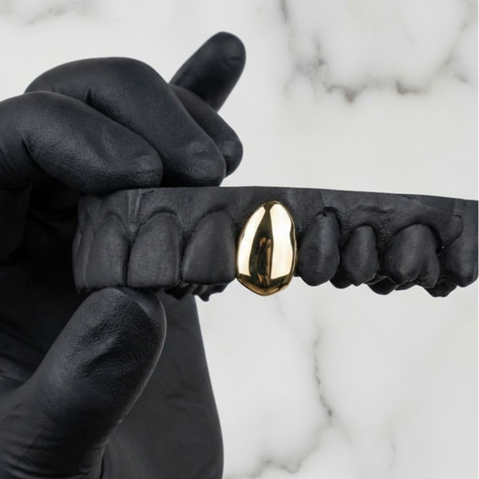 ION (GOLD PLATED GRILLZ)