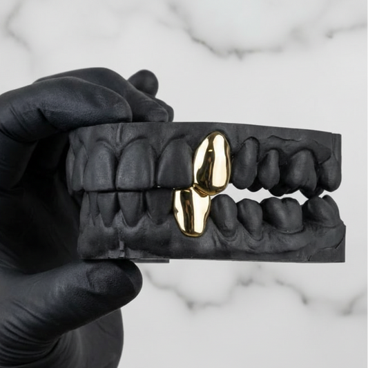 ROGUE (GOLD PLATED GRILLZ)