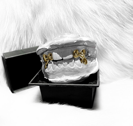 JET (GOLD PLATED GRILLZ)