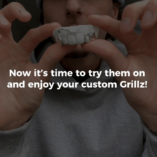 ION (GOLD PLATED GRILLZ)