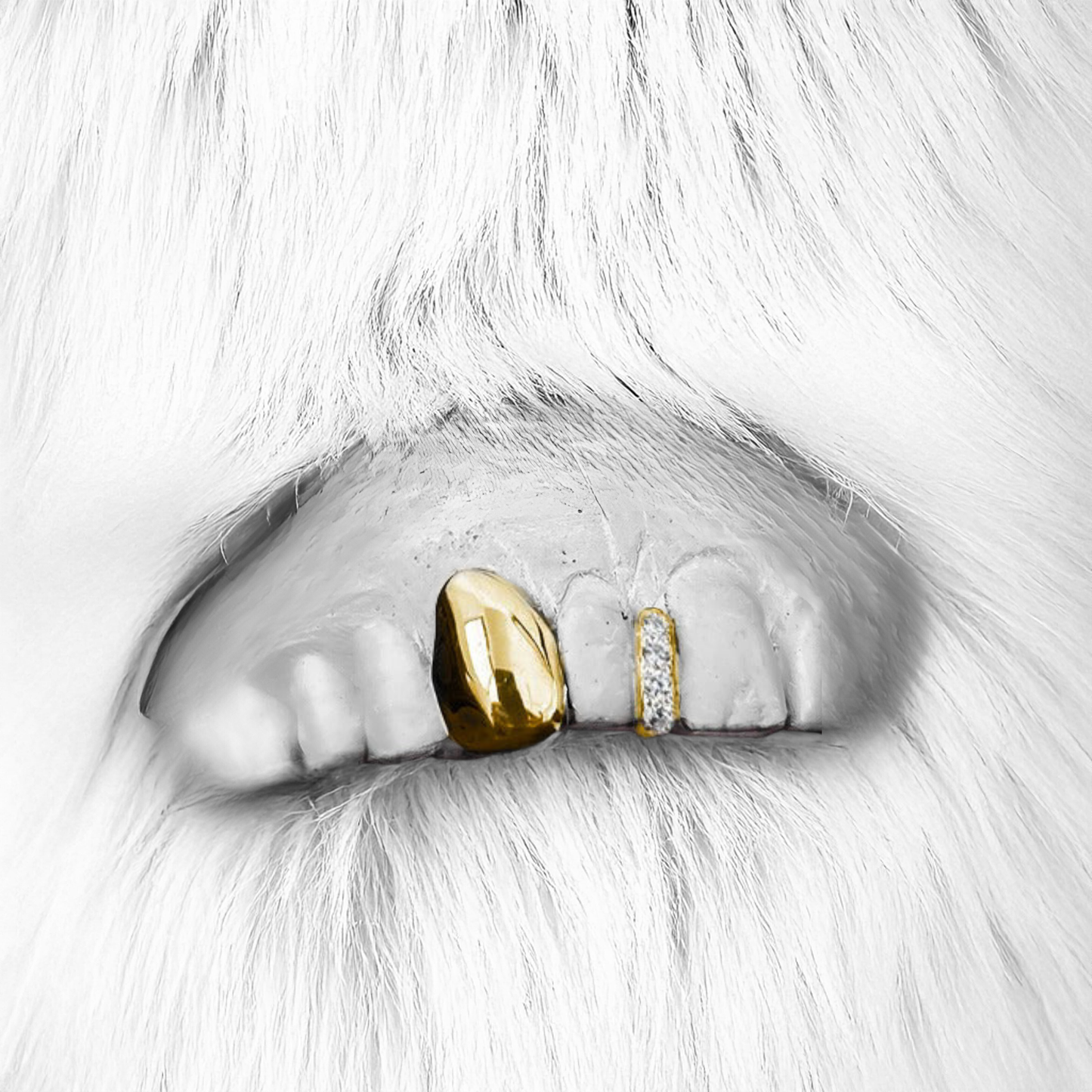 ZENITH (GOLD PLATED GRILLZ)