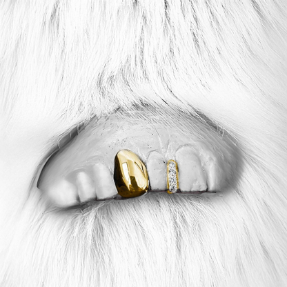 ZENITH (GOLD PLATED GRILLZ)