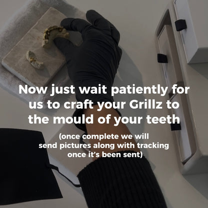 ION (GOLD PLATED GRILLZ)