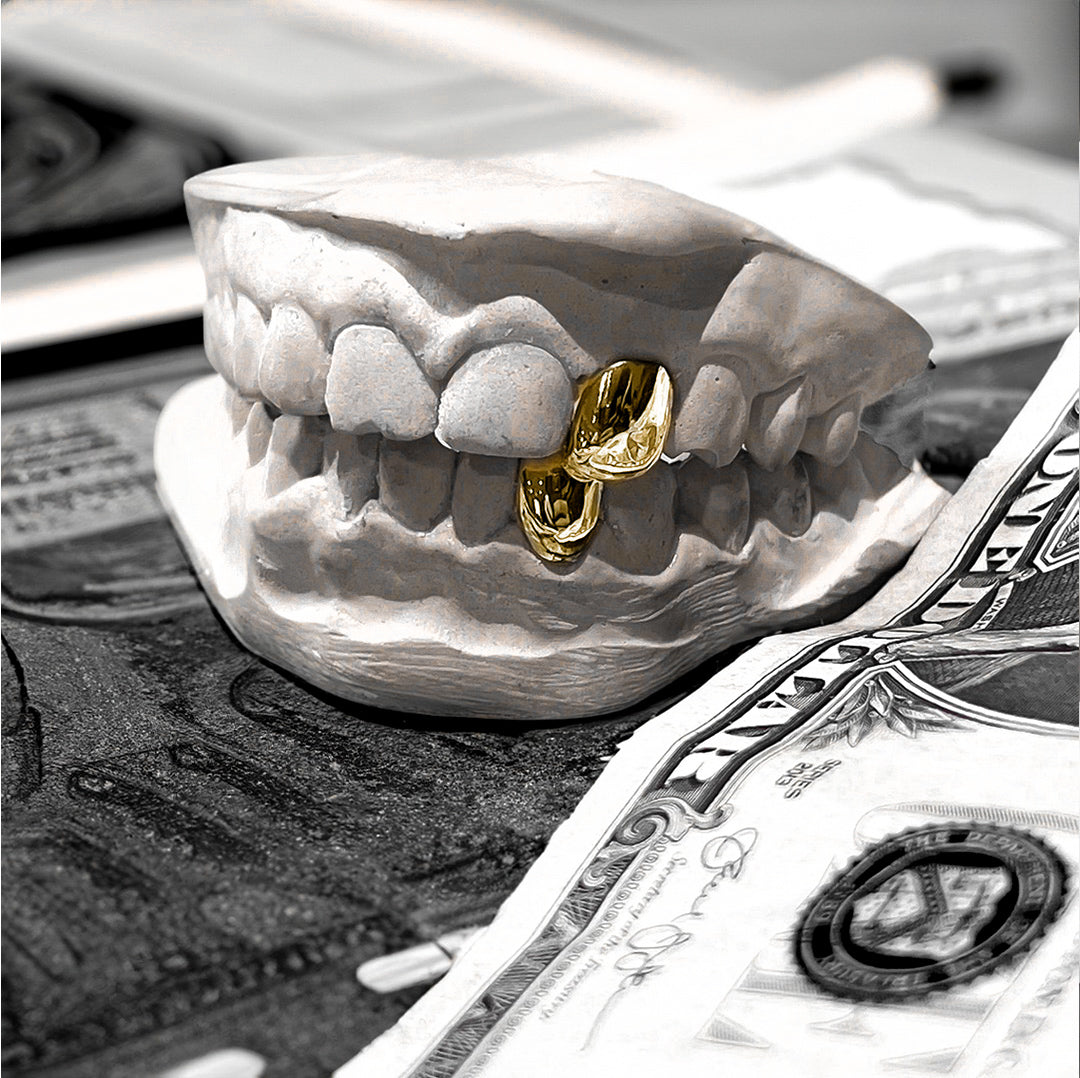 ECHO (GOLD PLATED GRILLZ)