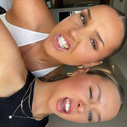 PRISM (GOLD PLATED GRILLZ)