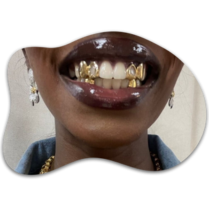 Solid Gold Grillz
