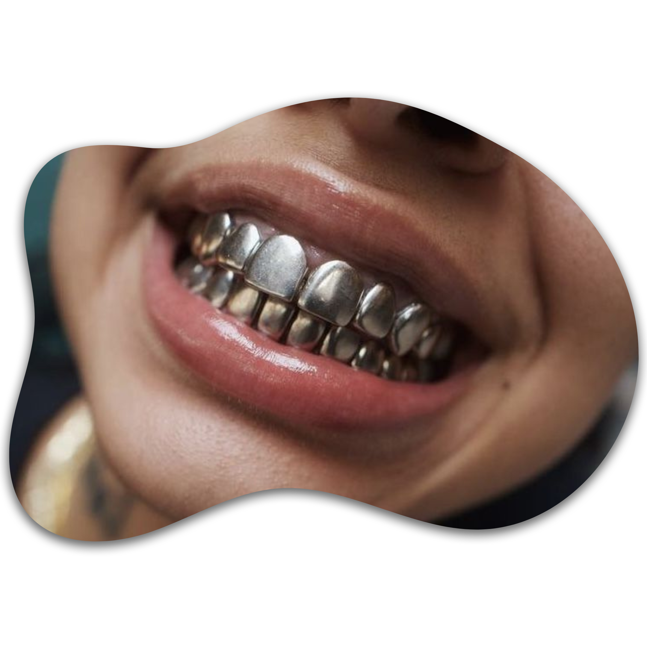 Silver & White Gold Grillz