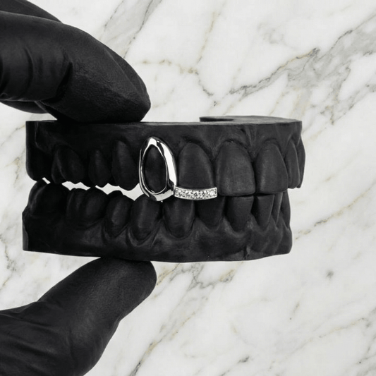 ARC 02 (GOLD GRILLZ) - 10k - HC Grillz