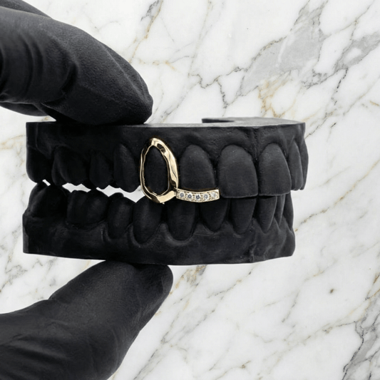 ARC 02 (GOLD GRILLZ) - 10k - HC Grillz