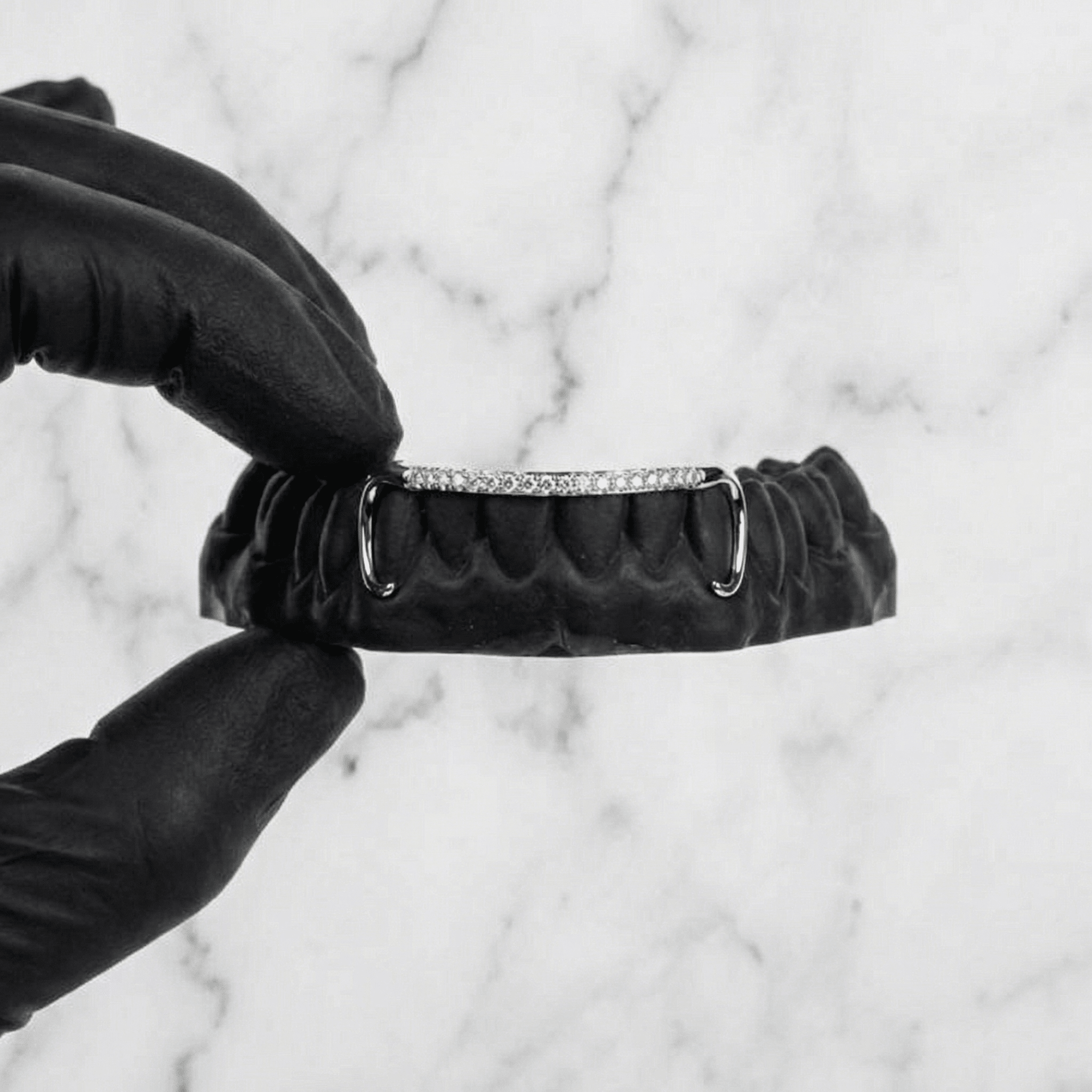 AURIX (GOLD GRILLZ) - White - HC Grillz