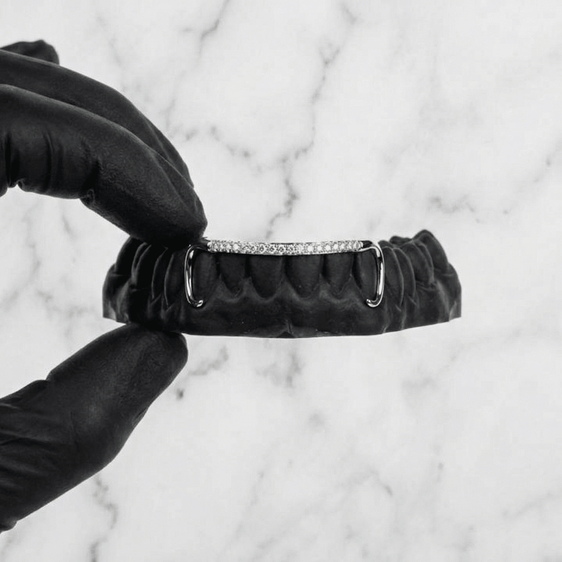 AURIX (GOLD GRILLZ) - White - HC Grillz