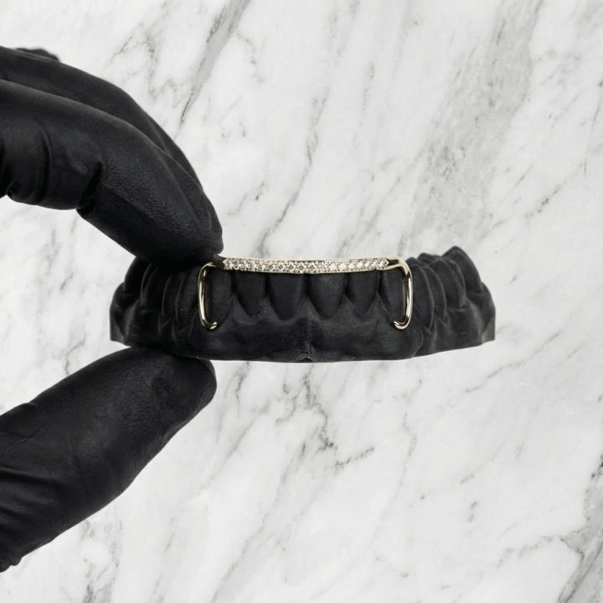 AURIX (GOLD GRILLZ) - Yellow - HC Grillz