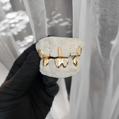 NYVEX (CUSTOM GOLD GRILLZ)