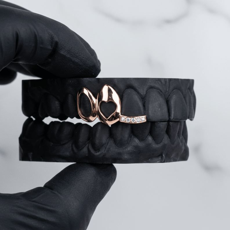 HORIZON (GOLD PLATED HEART GRILLZ) - Rose - HC Grillz