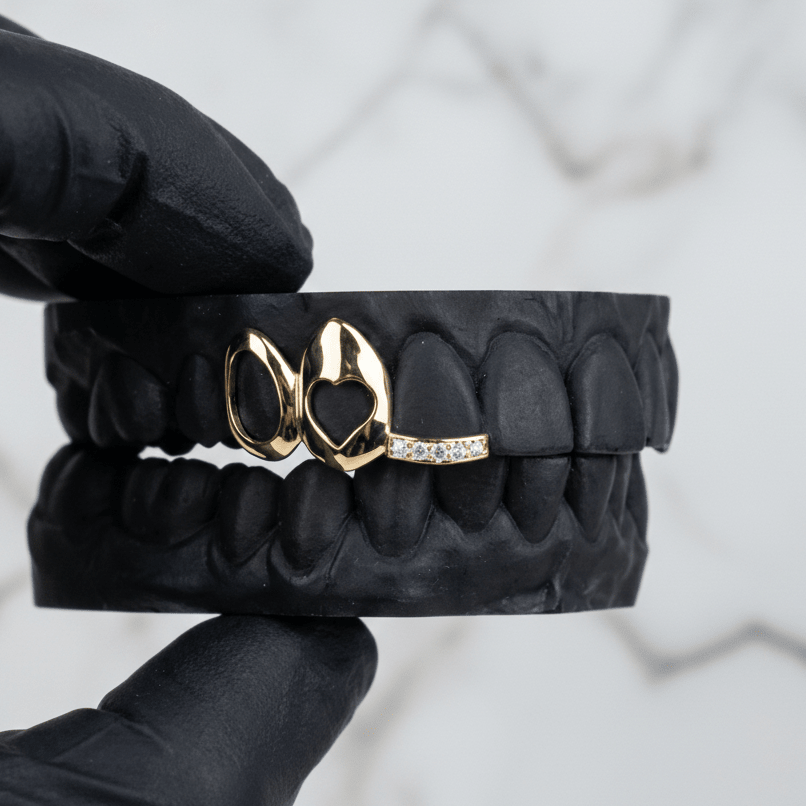 HORIZON (GOLD PLATED HEART GRILLZ) - Yellow - HC Grillz