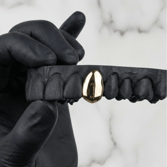 ION GOLD PLATED ADD ON - HC Grillz