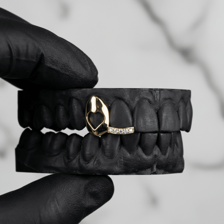 MIRAGE (GOLD PLATED HEART GRILLZ) - Yellow - HC Grillz