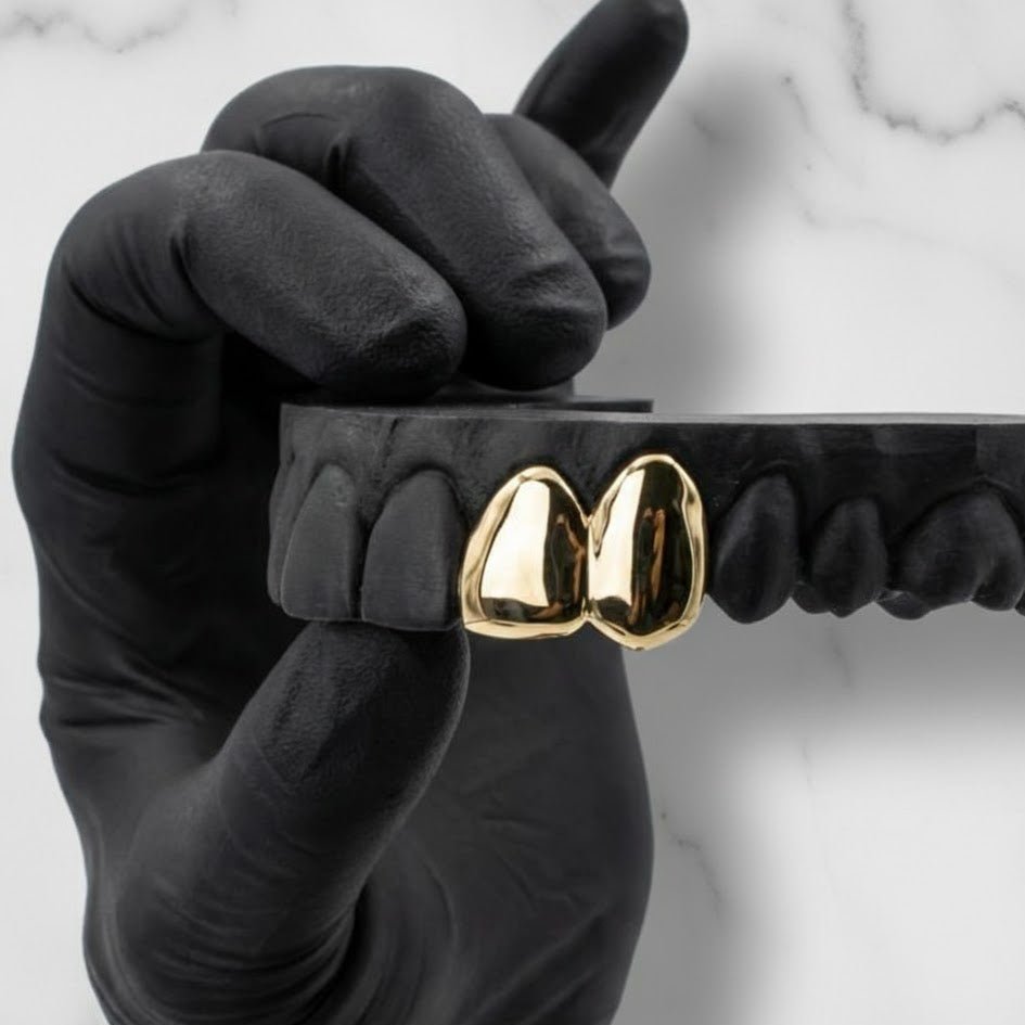 NOVA GOLD PLATED ADD ON - HC Grillz