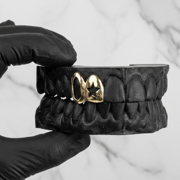 ORION (GOLD PLATED STAR GRILLZ) - Yellow - HC Grillz