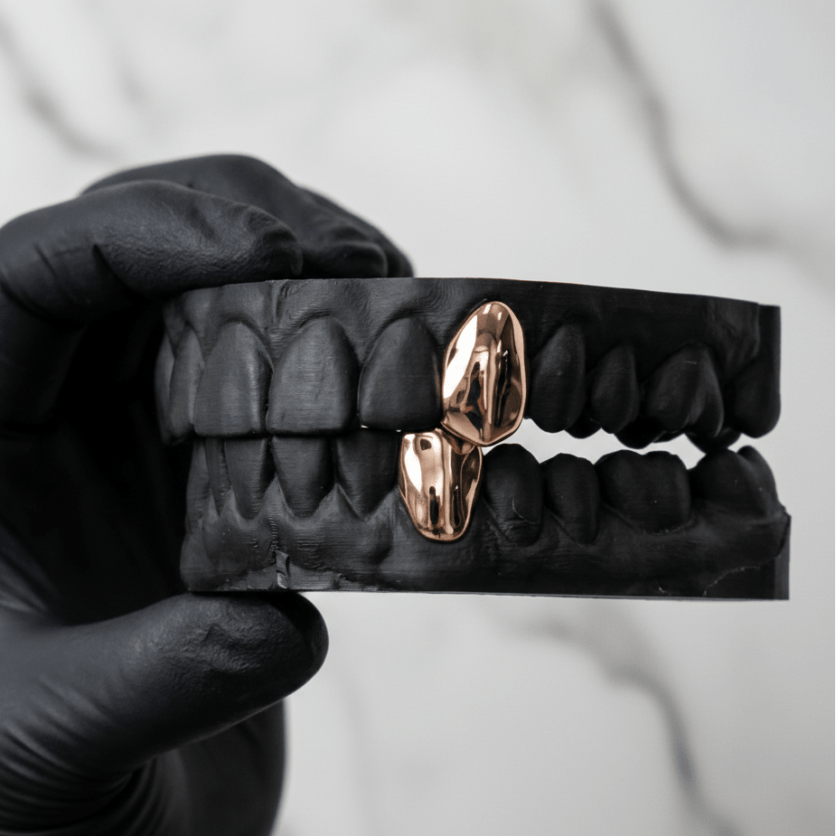 ROGUE (GOLD PLATED GRILLZ) - Rose - HC Grillz