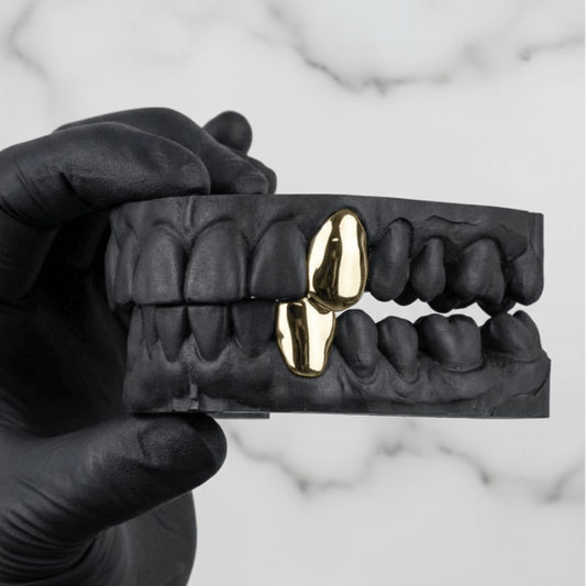 ROGUE (GOLD PLATED GRILLZ) - Yellow - HC Grillz