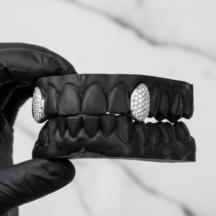 SENTINEL (ICED OUT GOLD GRILLZ) - 10k Gold & Diamonds - HC Grillz