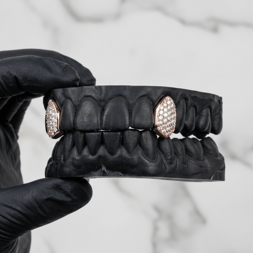 SENTINEL (ICED OUT GOLD GRILLZ) - 10k Gold & Diamonds - HC Grillz