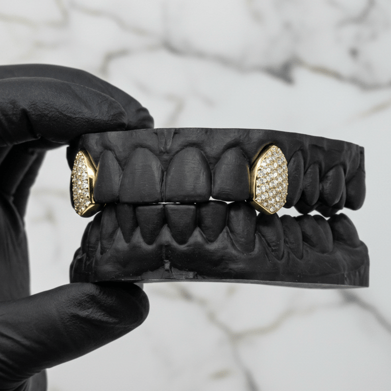 SENTINEL (ICED OUT GOLD GRILLZ) - 10k Gold & Diamonds - HC Grillz