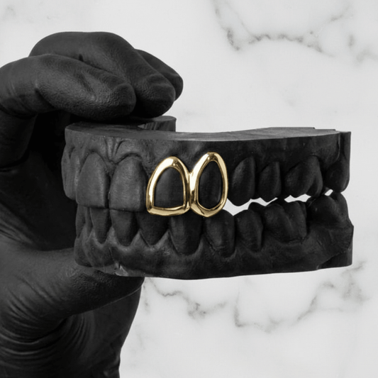 SPARK (GOLD GRILLZ) - 10k - HC Grillz