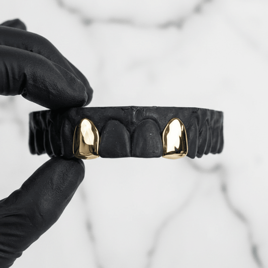 SURGE (GOLD PLATED GRILLZ) - Yellow - HC Grillz