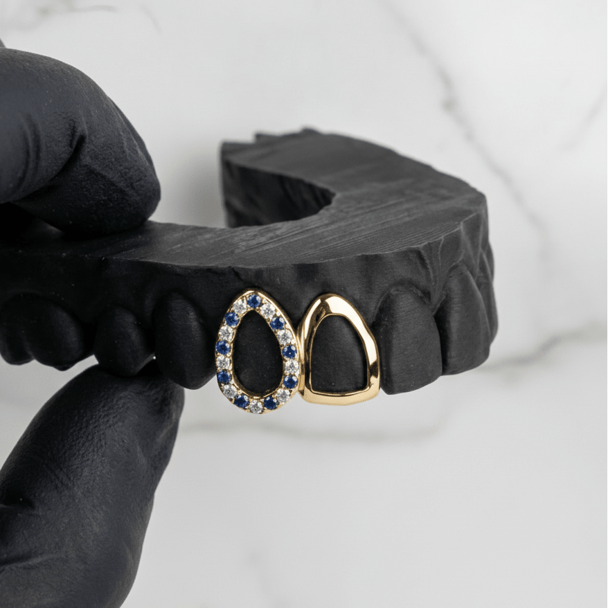 TESSER (GOLD GRILLZ) - 10k gold - HC Grillz